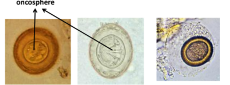 <p><strong>oncosphere or hexacanth embryo</strong> - larva that hatches from the egg, it actively penetrates the GIT or the IH and develops into <strong>metacestodes. </strong></p><p><strong>we describe: </strong></p><ol><li><p><em>shape:</em><span style="color: red"><em> spherical/oval</em></span></p></li><li><p><em>size: </em><span style="color: red"><em>small</em></span></p></li><li><p><em>shell: thick, shell - often striated (has fine lines/ridges)</em></p></li><li><p><em>content: </em><span style="color: red"><em>has a hexacanth embryo (oncosphere) - with 6 hooklets for attachment.</em></span></p></li><li><p><em>color:</em><span style="color: red"><em> brownish/yellowish</em></span></p></li><li><p><span style="color: red"><em>embryonated</em></span><em> and infective when passed in the feces of the final host</em></p></li></ol><p></p>