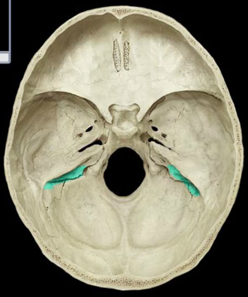 <p>Hole posterior to mastoid process</p>