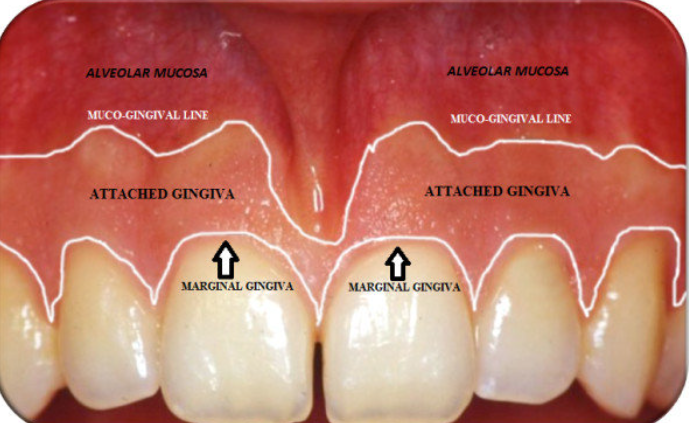<p>Lining mucosa</p><p>Non keratinized</p><p>Movable, loosely attached</p><p>MGJ-mucogingival junction-separated</p><p>alveolar mucosa and attached gingiva</p><p>Darker red in color</p><p>Highly vascularized</p>