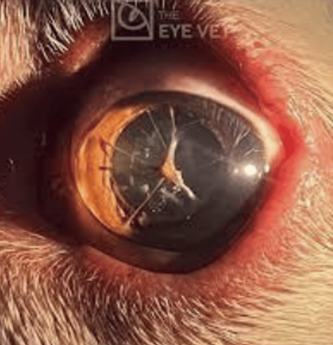 <p>- Persistent pupillary membrane which covers developing iris and lens</p>