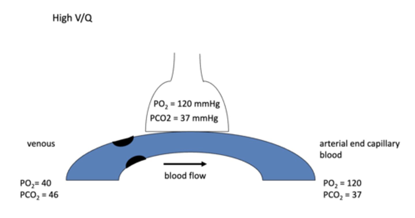 <p>increased PAO2 &amp; decreased PACO2 ==&gt; b/c not as much blood available for exchange so less exchange happens at the alveoli</p><p>*(PaO2 &amp; PaCO2 at the arterial end of capillary will be the same as the PAO2 &amp; PACO2 b./c the exchange bwtn alveoli &amp; blood will always be 1:1)</p>
