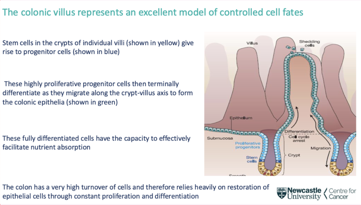 <p><span style="background-color: inherit; line-height: 22px; color: windowtext;"><span>Colon- good example of interplay between stem cells progenitor cells and fully differentiated cells&nbsp;</span></span><span style="line-height: 22px; color: windowtext;"><span>&nbsp;</span></span></p><p><span style="background-color: inherit; line-height: 22px; color: windowtext;"><span>Undifferentiated cells in stem cell crypts- can differentiate and partially differentiate into progenitor cells (mostly useless)</span></span><span style="line-height: 22px; color: windowtext;"><span>&nbsp;</span></span></p><ul><li><p class="Paragraph SCXO158002374 BCX0" style="text-align: left;"><span style="background-color: inherit; line-height: 22px; color: windowtext;"><span>They move up and acquire more characteristics of colon cell- fully differentiated when they reach the villus- able to absorb food at this point</span></span><span style="line-height: 22px; color: windowtext;"><span>&nbsp;</span></span></p></li></ul><p class="Paragraph SCXO158002374 BCX0" style="text-align: left;"><span style="background-color: inherit; line-height: 22px; color: windowtext;"><span>This process is under tight control</span></span><span style="line-height: 22px; color: windowtext;"><span>&nbsp;</span></span></p>