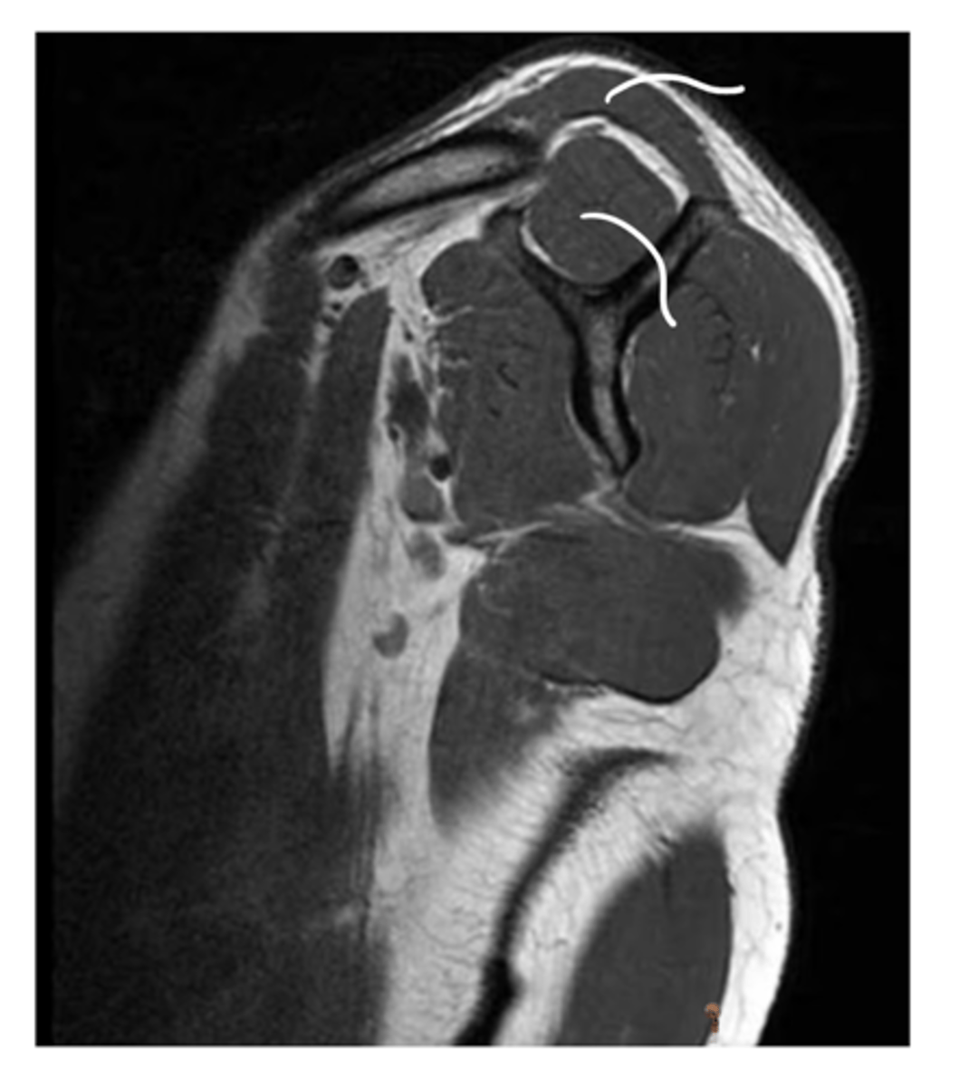 <p>Which structures are being pointed to in this image?</p>