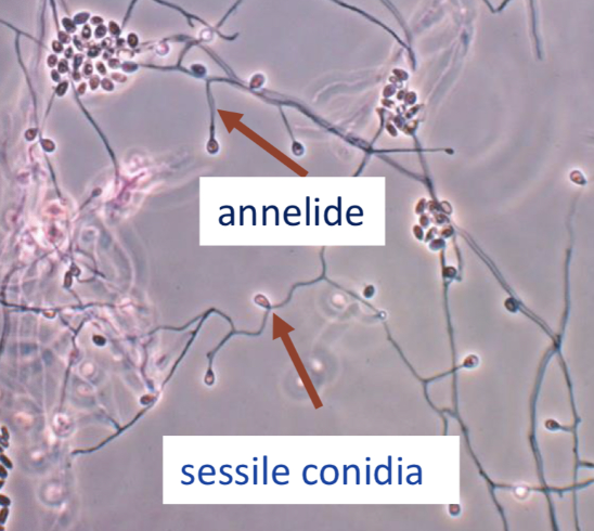 <p>Scedosporium Apiospermum</p>