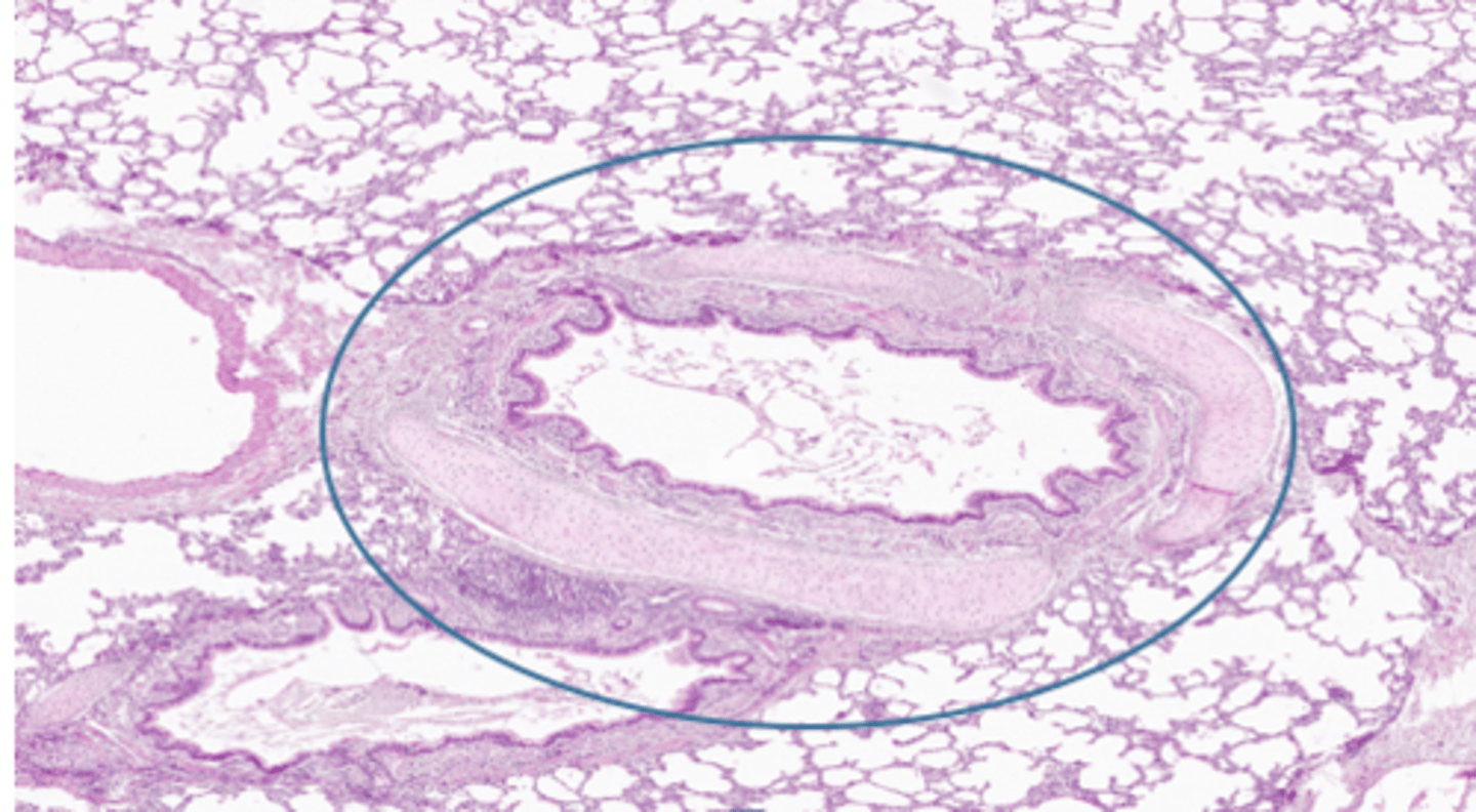 <p>ciliated pseudostratified columnar epithelium- goblet cells still producing mucus</p><p>plates of hyaline cartilage- no rings</p>