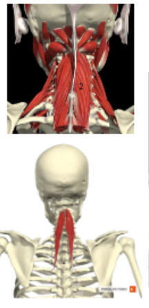 <p><span><span>M. semispinalis cervicis</span></span></p>