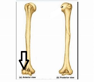 <p>what part of the humerus is this?</p>
