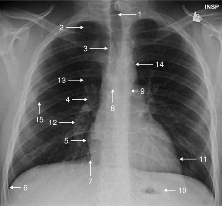 <p>What anatomical structure is number 11?</p>