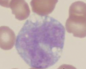 What type of leukocyte is this?