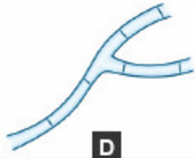 <p>Name the <strong>Type of Hyphae</strong></p>