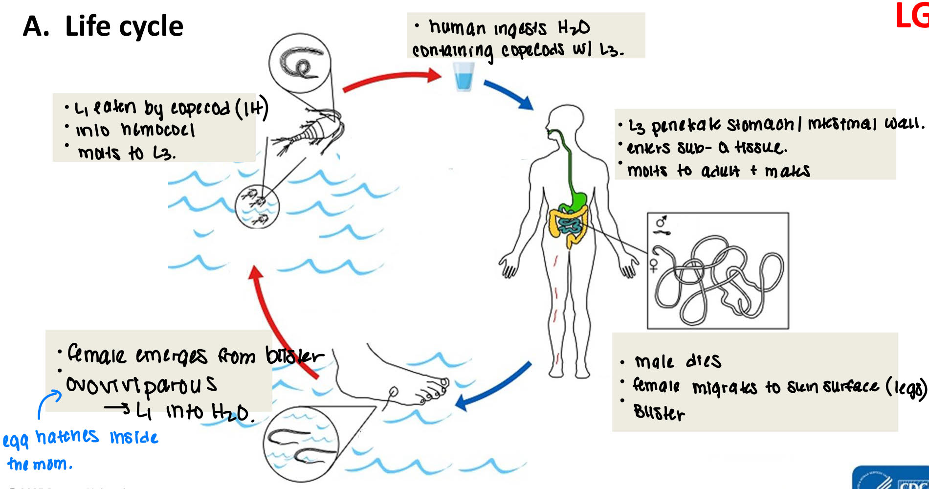 <ol><li><p>human ingests H2O containing copecods with L3</p></li><li><p>L3 penetrate stomach/intestinal wall → enters sub-q tissue → molts to adult + mates</p></li><li><p>male dies → female migrates to skin surface (legs) → blisters</p></li><li><p>female emerges from blister → ovoviviparous → L1 into H2O.</p></li><li><p>L1 eaten by copecod (IH) → into hemocoel → molts to L3. </p></li></ol><p></p>
