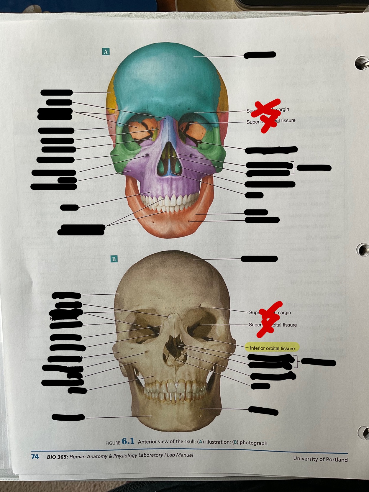 Inferior orbital fissure