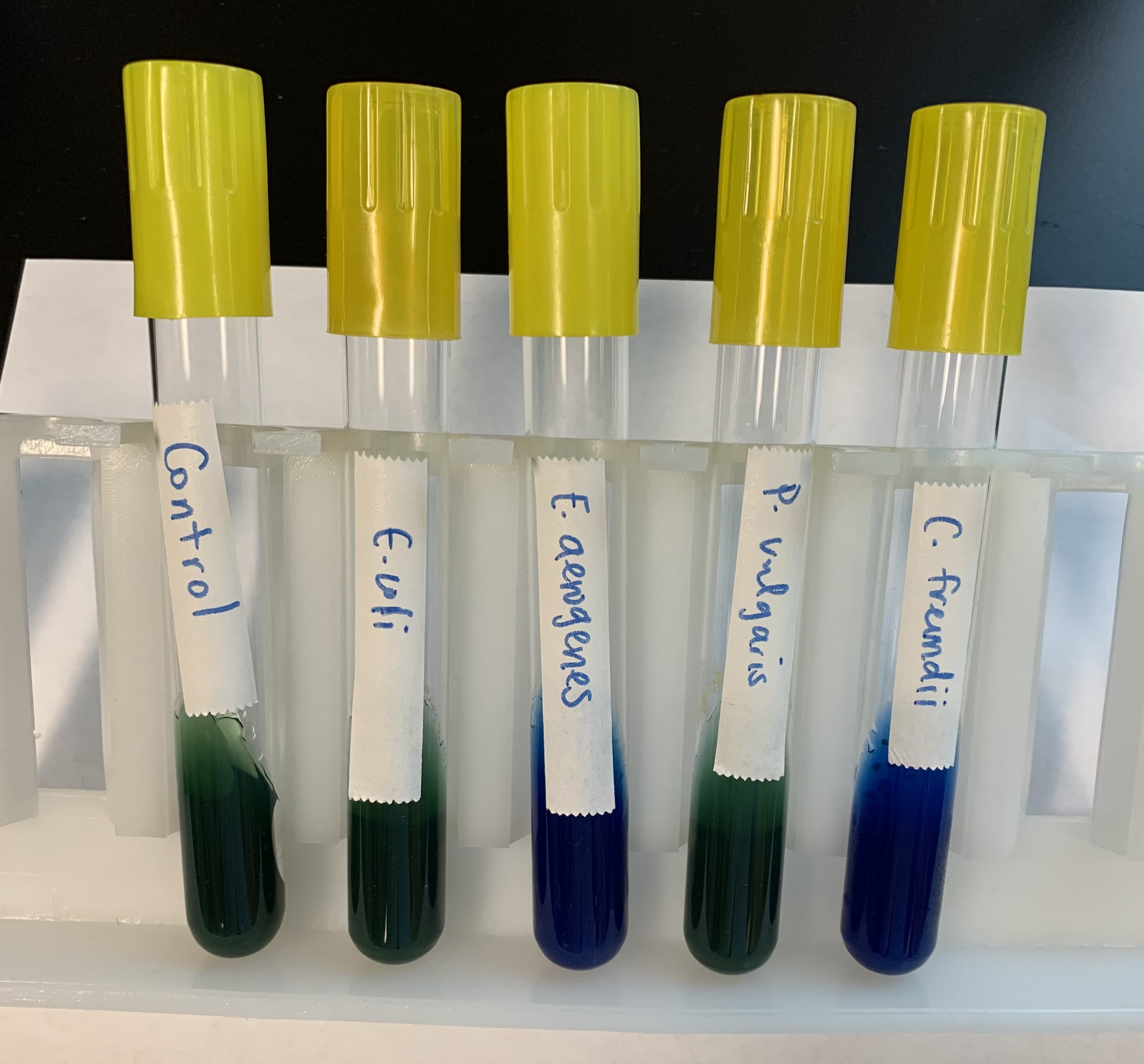 <p>What does a positive and negative test mean for Sodium Citrate test?</p>