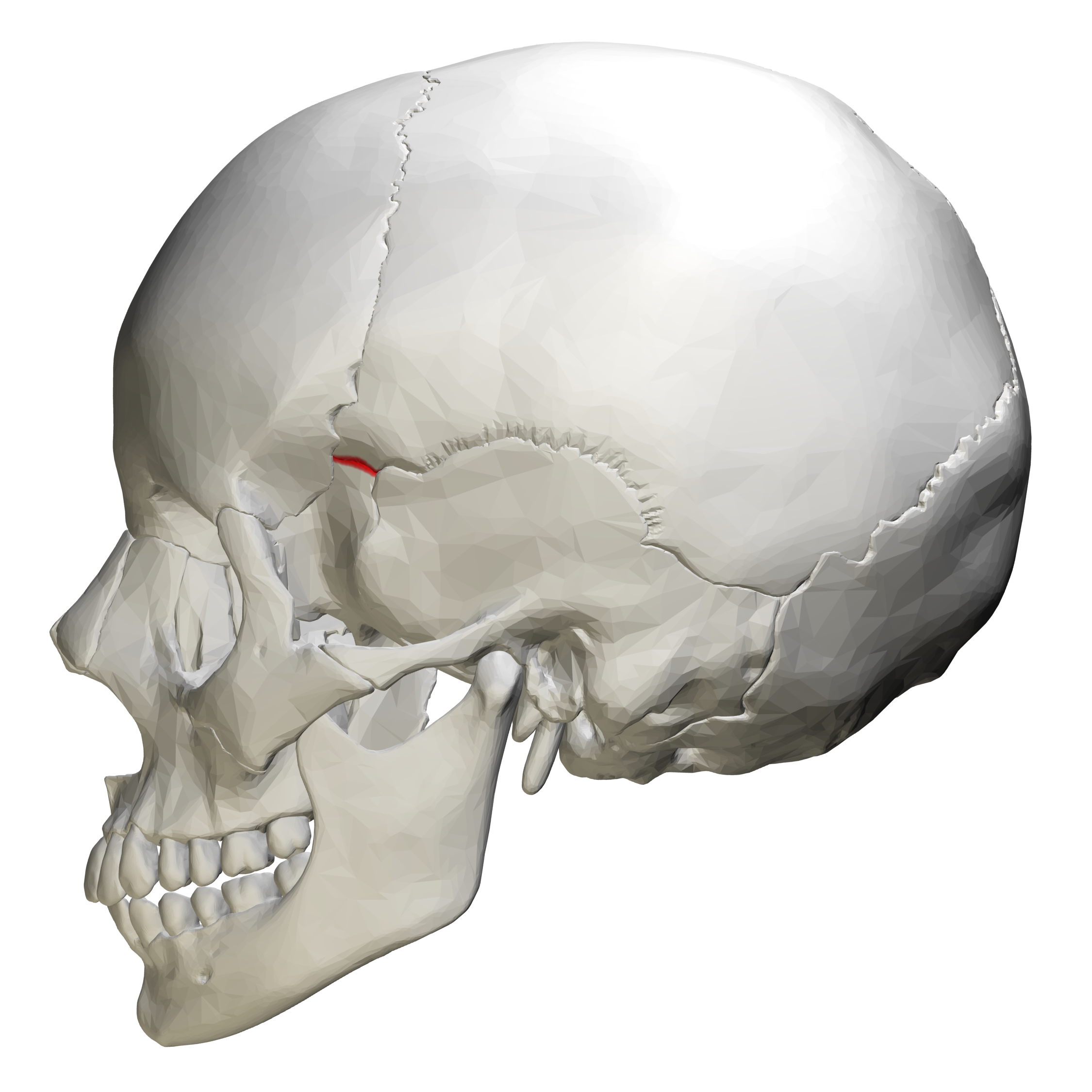 <p>Sutura sphenoparietale ndan ashtin parietal nga ala major e ashtit sfenoidal.</p>