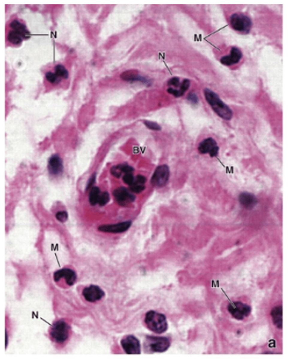 <p>What is the cytoplasmic staining characteristic of macrophages?</p>