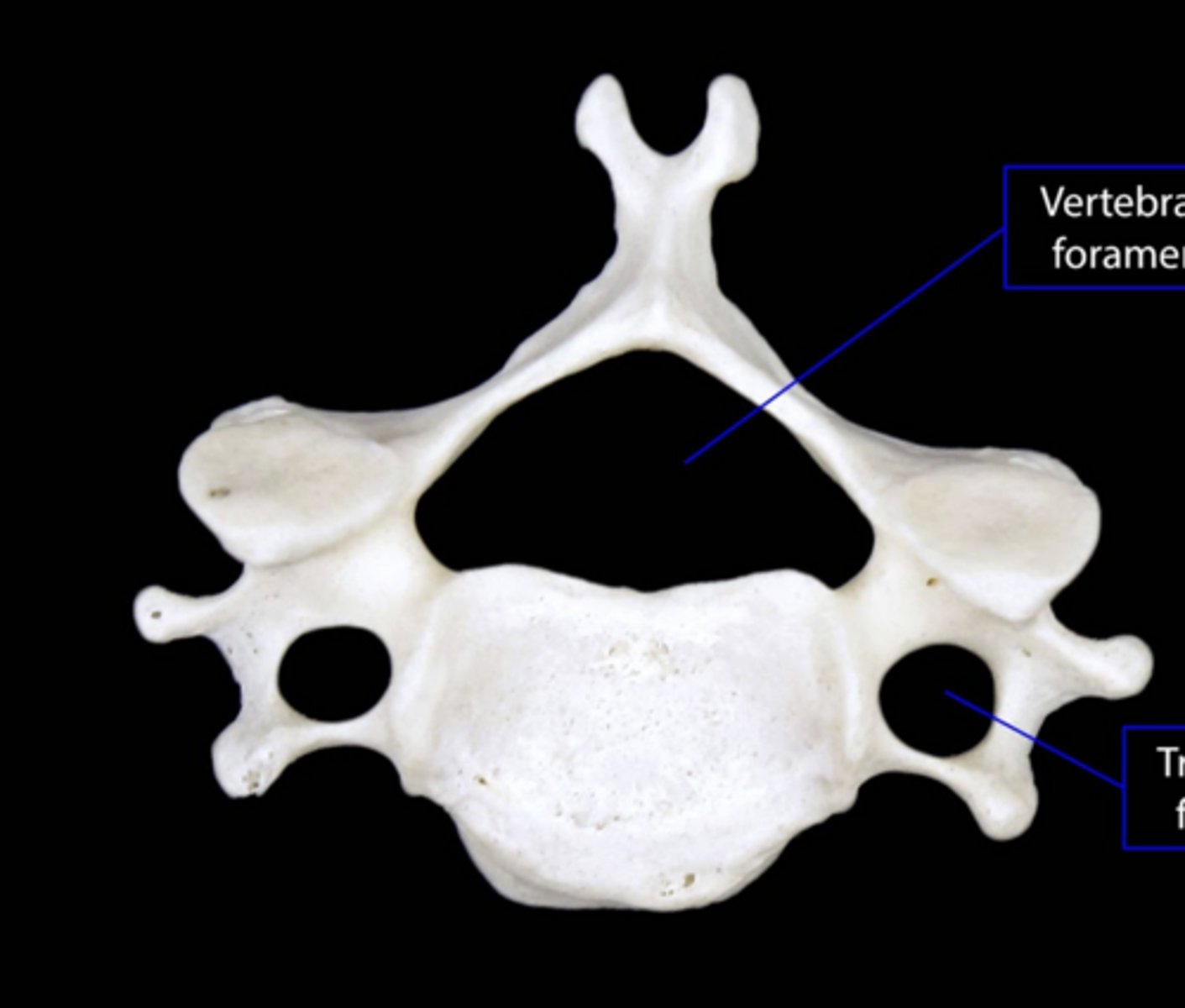 <p>Type of vertebrae</p>