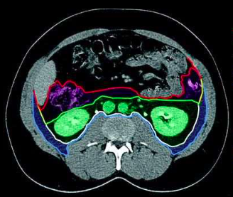 <p>(white outline)</p>