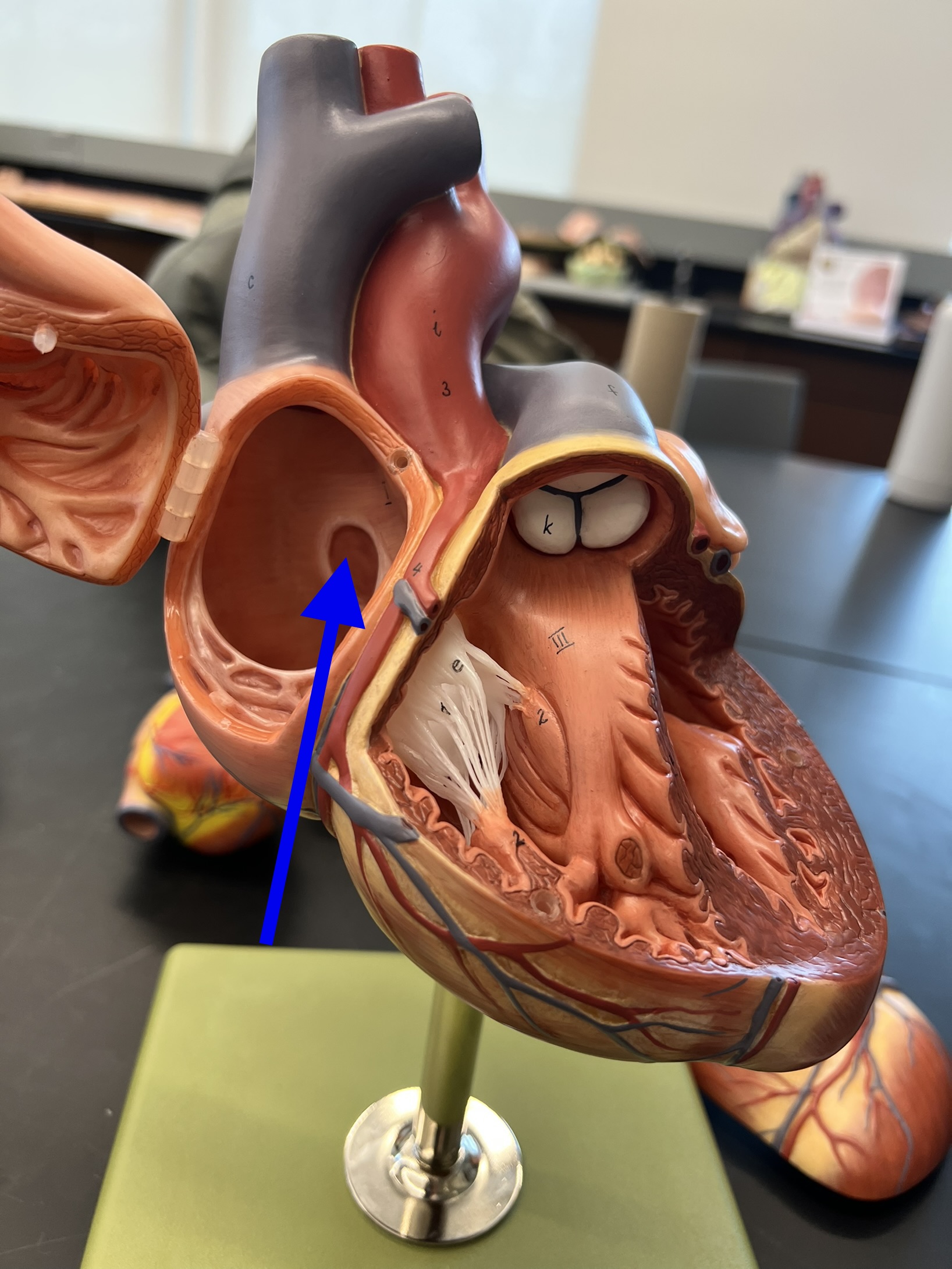 Name the heart structure.