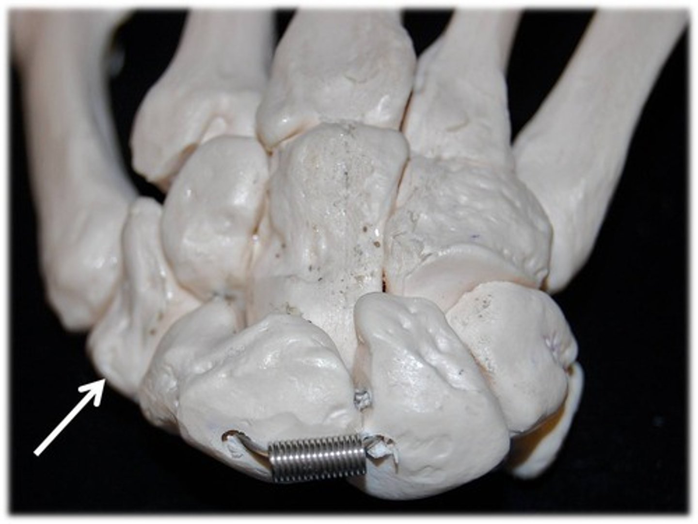 <p>Name this specific bone of the hand (posterior view).</p>