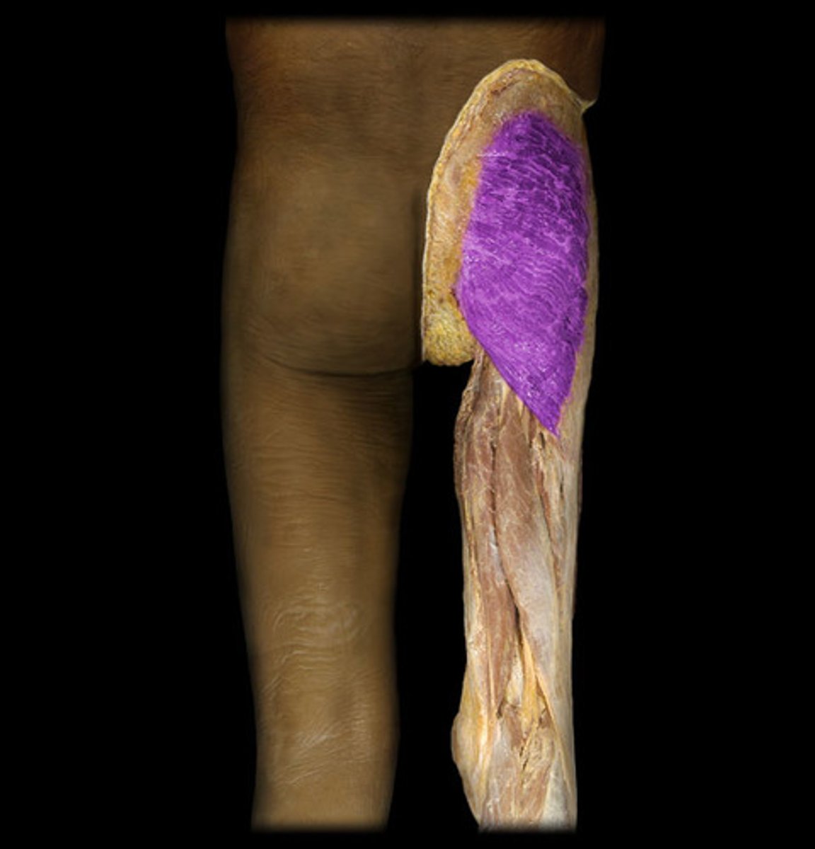 <p>Origin: Iliac crest, sacrum, sacrotuberous ligament</p><p>Insertion: Iliotibial tract, gluteal tuberosity, femoral shaft</p>