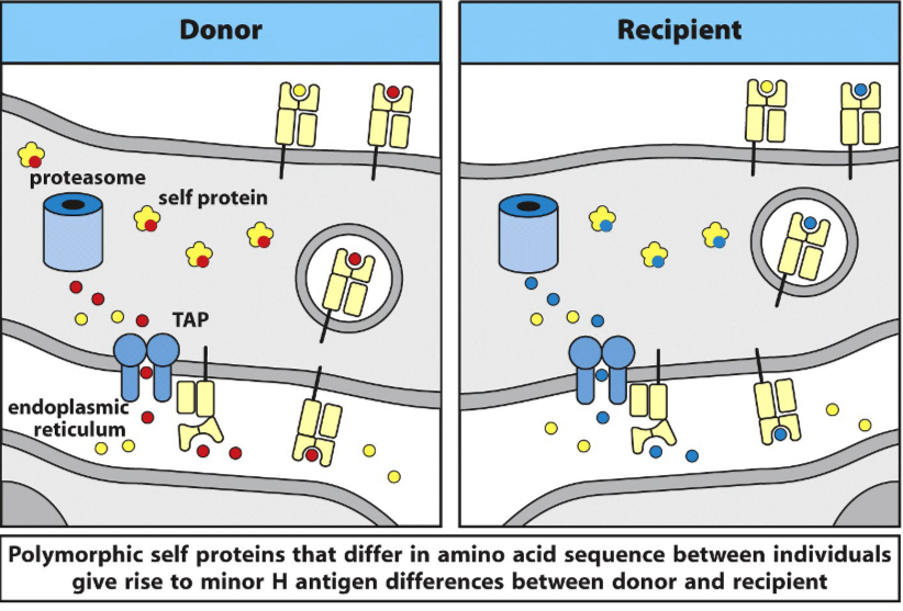 <p><span><span>Examples of minor histocompatibility antigens (mHA) include&nbsp;</span><strong><u><span>HA-1</span></u></strong><span>,&nbsp;</span><strong><u><span>HA-2</span></u></strong><span>,&nbsp;</span><strong><u><span>HB-1</span></u></strong><span>, and&nbsp;</span><strong><u><span>HY</span></u></strong><span>&nbsp;(sex-linked antigens). These are different versions of the same protein encoded by different alleles of a gene, leading to an immune response against the foreign version, such as in a male-to-female bone marrow transplant. Other examples include&nbsp;</span><strong><u><span>ACC-1</span></u></strong><span>,&nbsp;</span><strong><u><span>ACC-2</span></u></strong><span>,&nbsp;</span><strong><u><span>HA-8</span></u></strong><span>, and&nbsp;</span><strong><u><span>UTDP4-1</span></u></strong><span>, which are identified by the genes they originate from.&nbsp;</span></span></p>