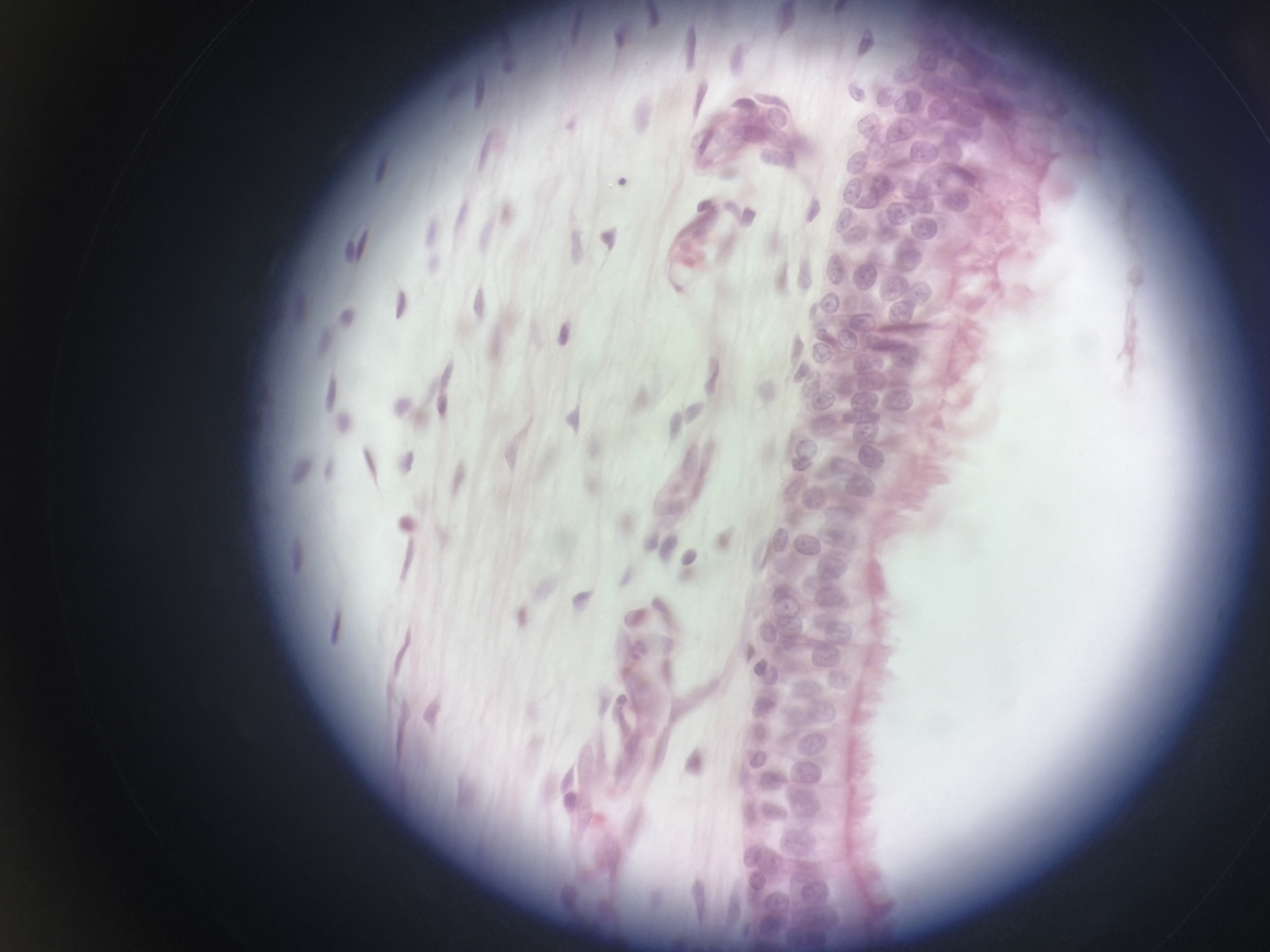 <p>tall varies in height cells and has cilia </p>