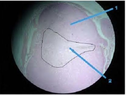 <p>1 &amp; 2</p>
