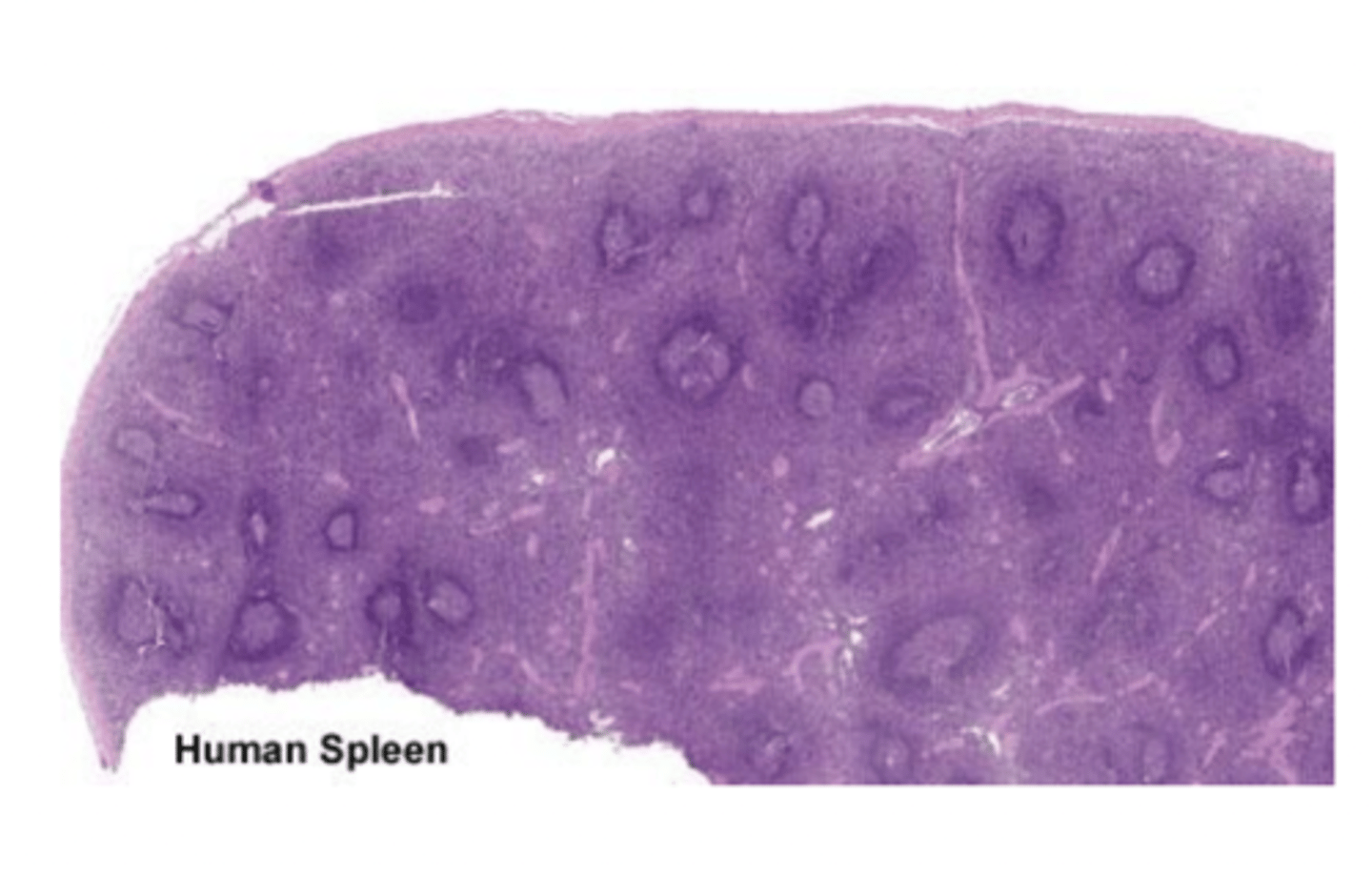 <p>tubular or parenchymal?</p>