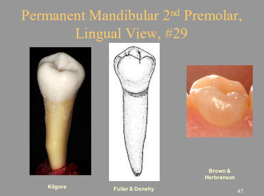 <p>Permanent Mandibular 2nd Premolar, Lingual View, #29</p>