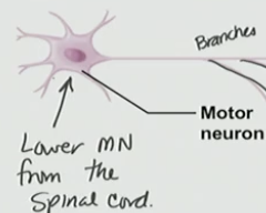 <p>Motor neuron</p>