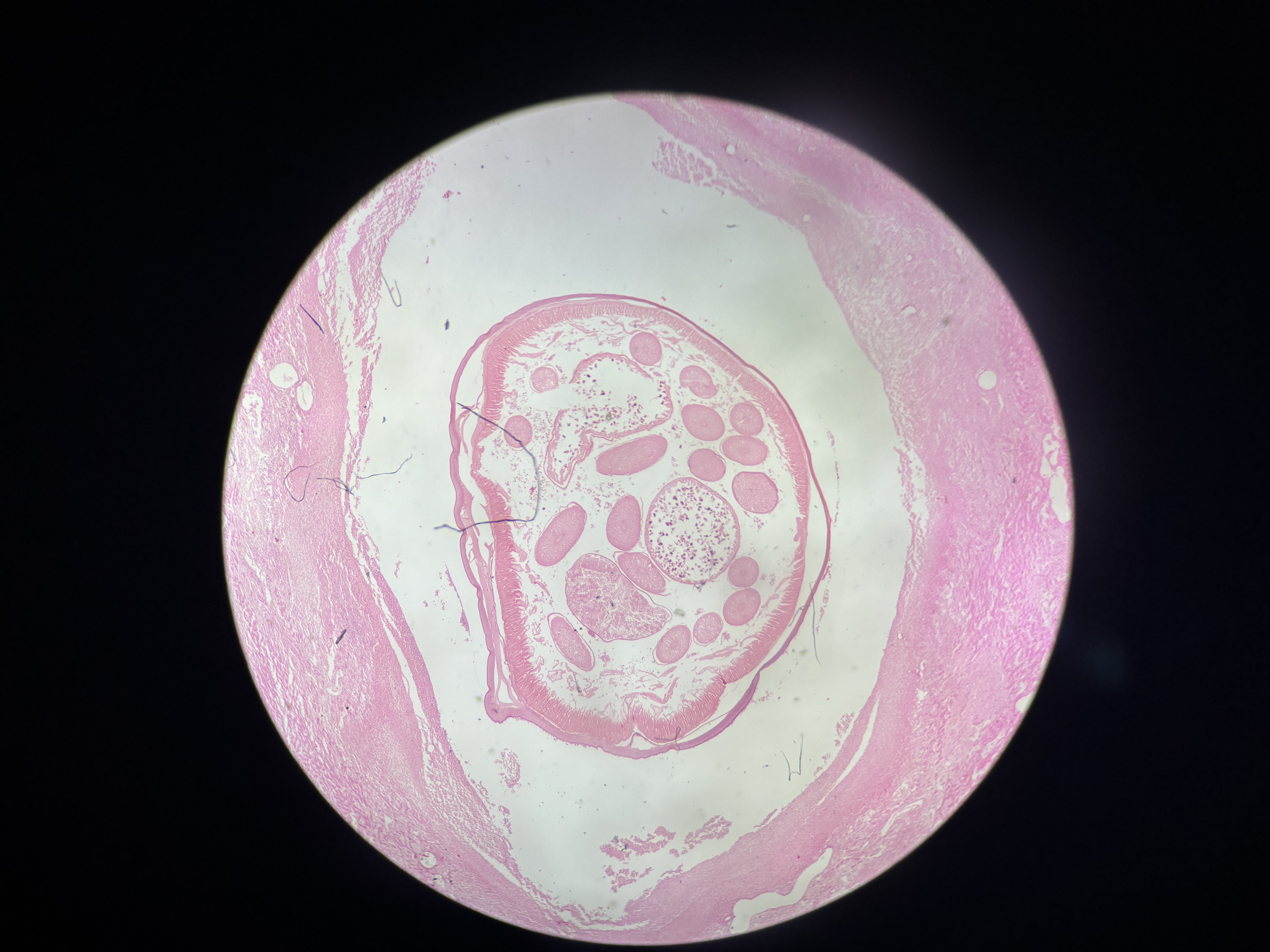 <p>Clase Fasmidia morf interna</p>