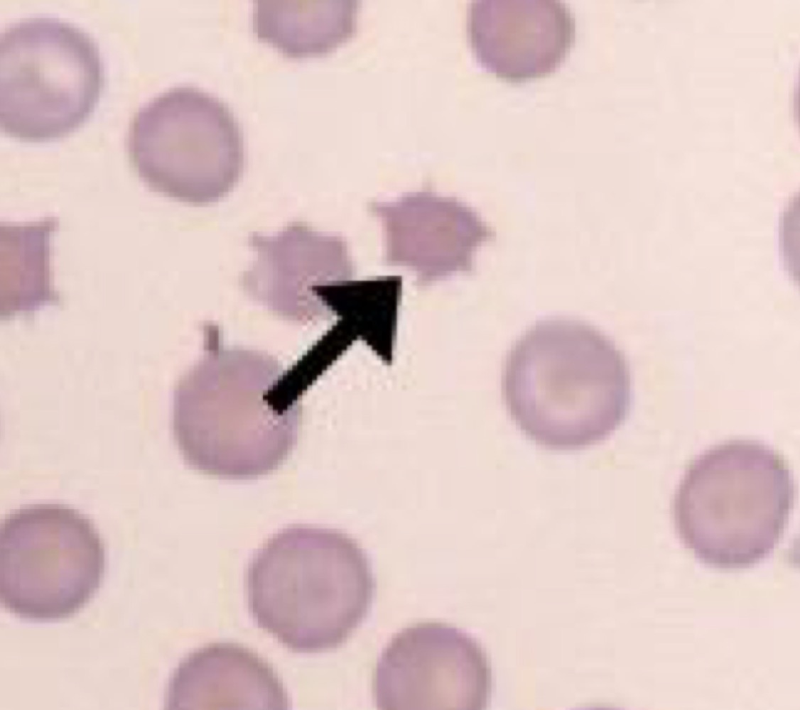 Name this RBC Abnormality.