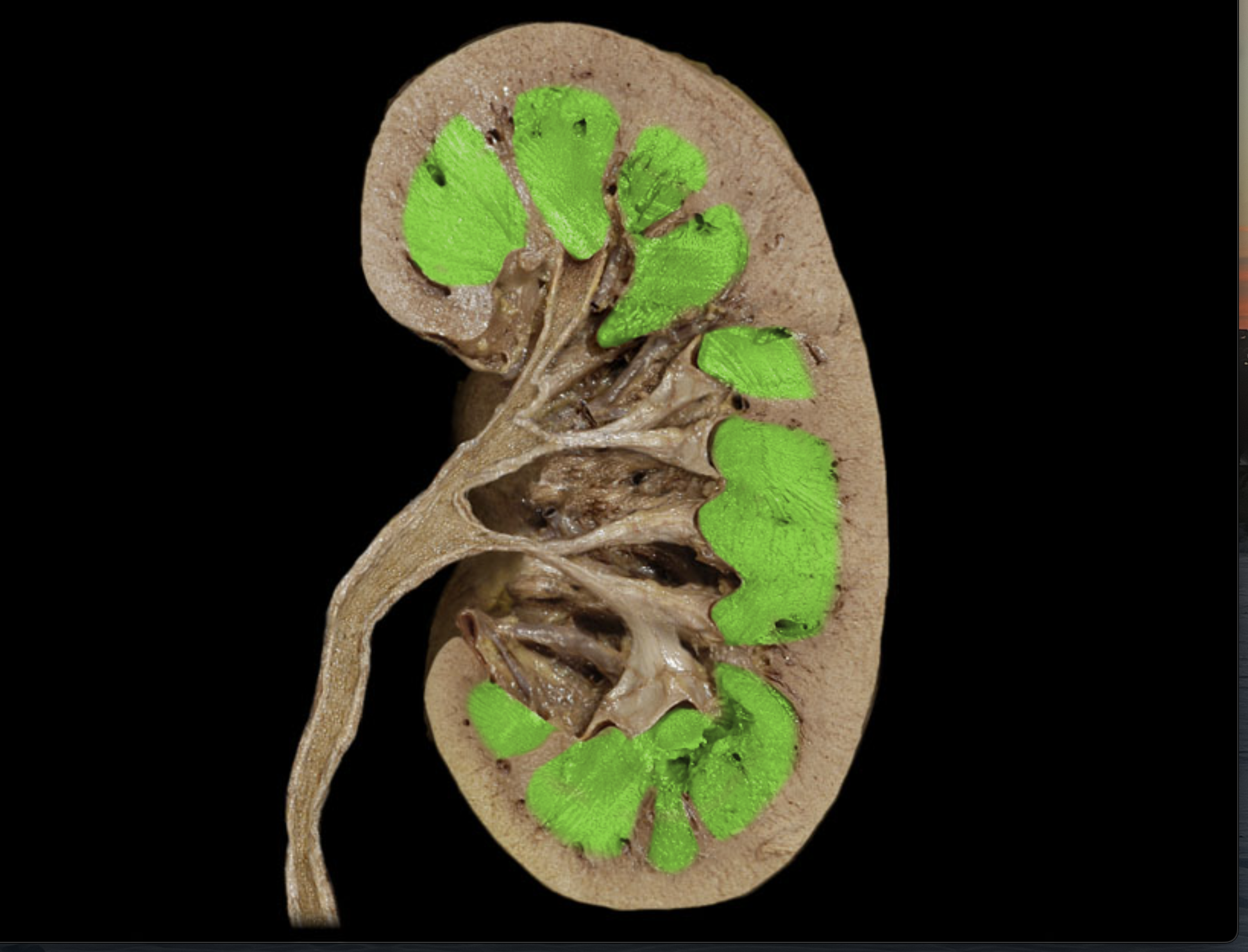 <p>Inner layer of kidney </p>