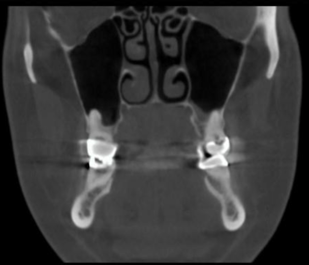 <p>what plane is this slice </p>