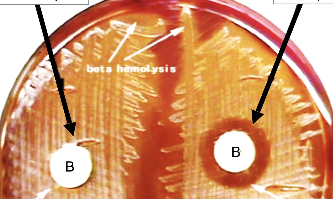 <p>Identification for <strong>Group A</strong> or <strong><em>S. pyogenes</em></strong></p>