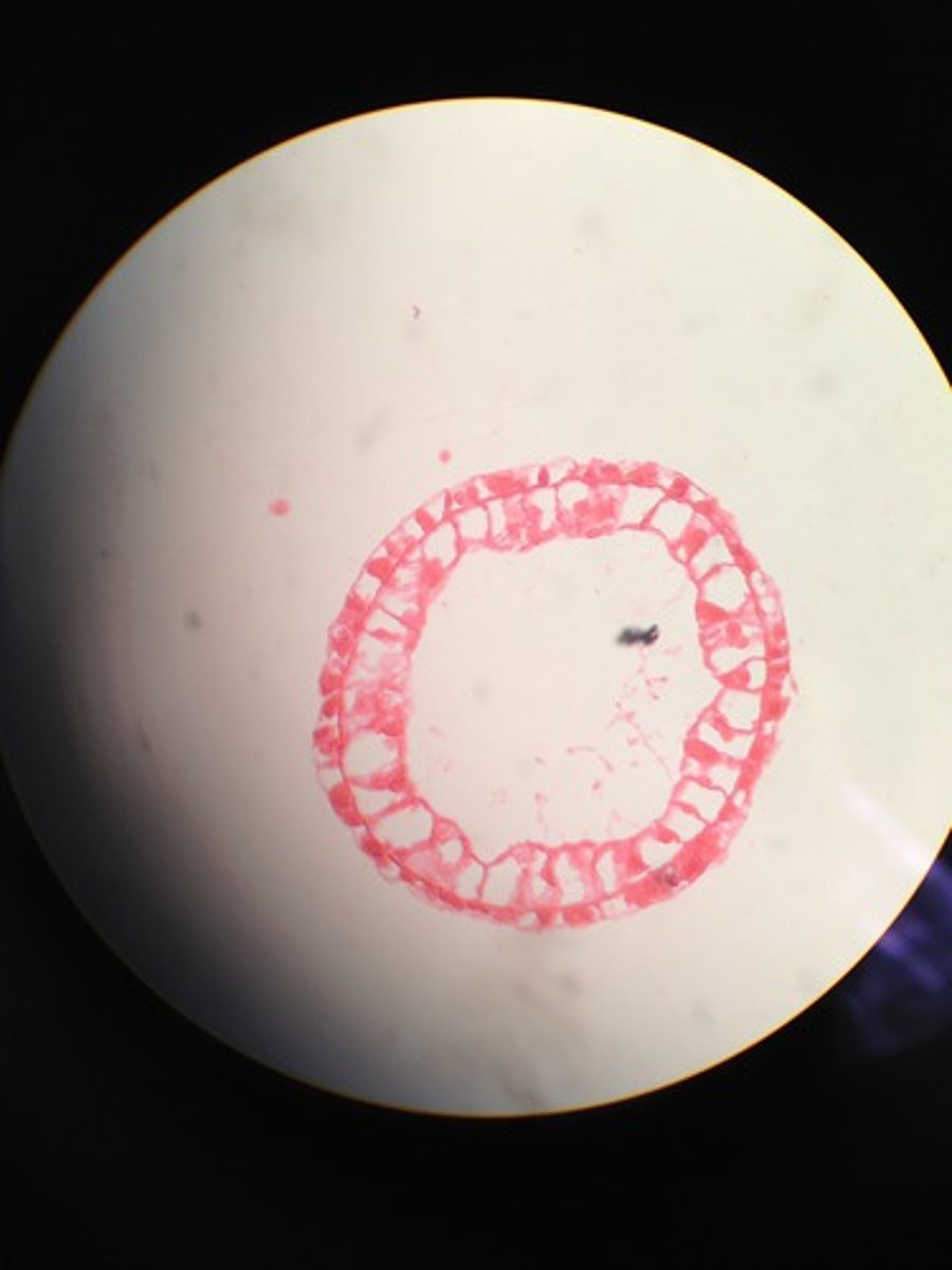 <p>-small, usually less than 1 cm tall<br>-live in shallow freshwater ponds<br>-prey on smaller invertebrates among the filaments and leaves of freshwater algae and plants<br>-have no medusa stage<br>-cells are organized into specialized tissues<br>-interior gut cavity is specialized for extracellular digestion</p>