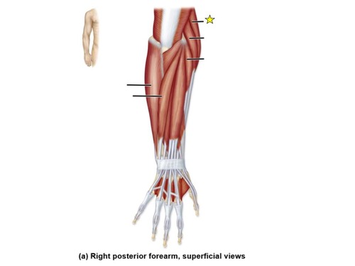 <p>identify the muscle</p>