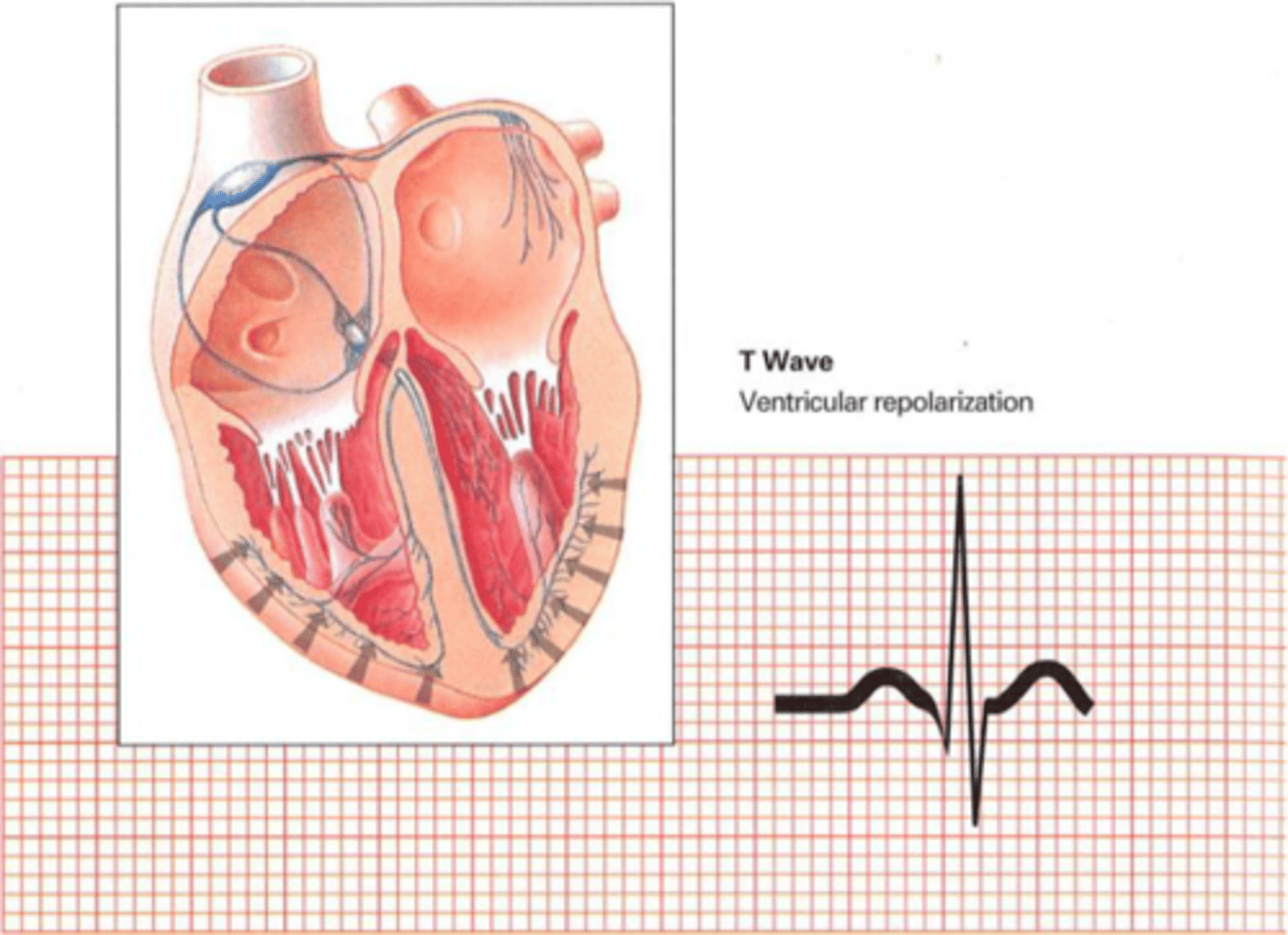 <p>Ventricular repolarisation occurs</p><p>Electrical charge in the pacemaker and myocyte cells return to polarised state with sodium outside and potassium inside the cell</p>