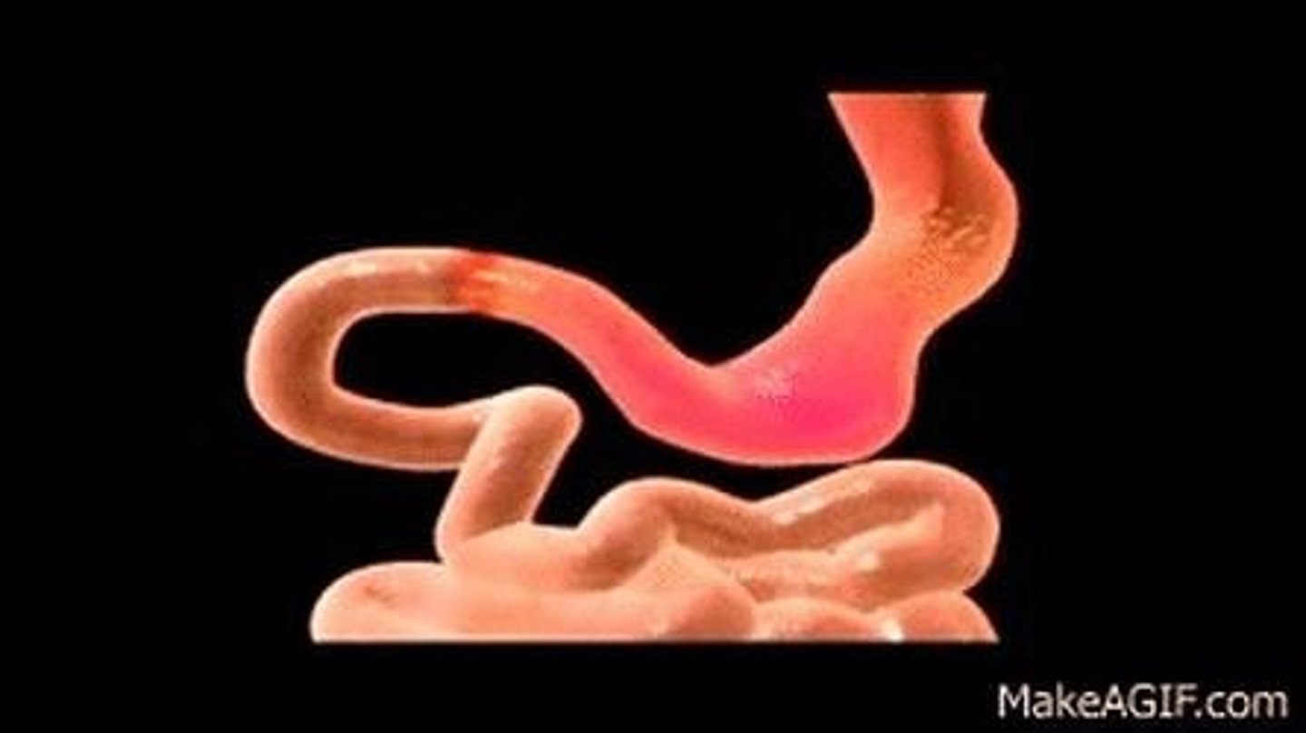 <p>Organ that secretes gastric juice containing hydrochloric acid and enzymes for protein digestion.</p>