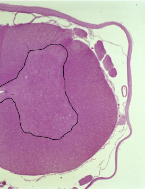 <p>White matter → on the OUTSIDE</p><p></p><p>Gray matter → on the INSIDE </p><ul><li><p>Has a butterfly shape; each side communicate with each other via the <strong>gray commissure </strong>(surrounds central canal of spine)</p></li><li><p>Has a<strong> dorsal horn → </strong>responsible for SENSORY, and a <strong>ventral horn</strong> → responsible for MOTOR</p></li></ul><p></p>