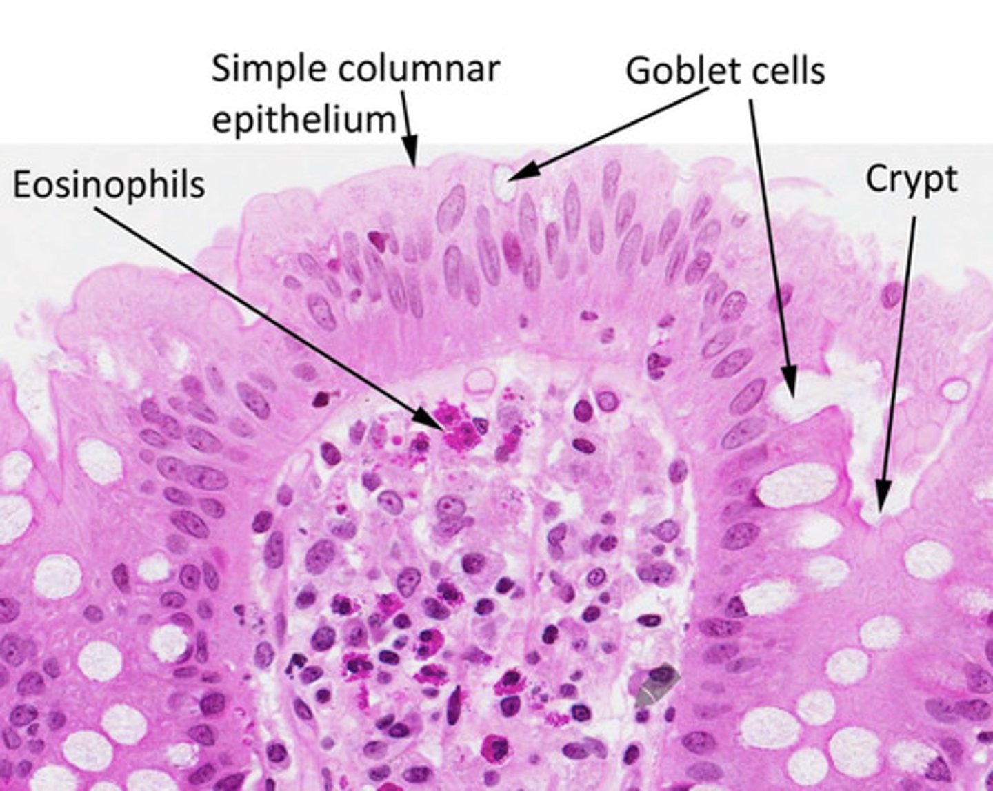<p>Eosinophils are abundant in the connective tissue of the intestinal lining and in the lungs of asthma patients.</p>
