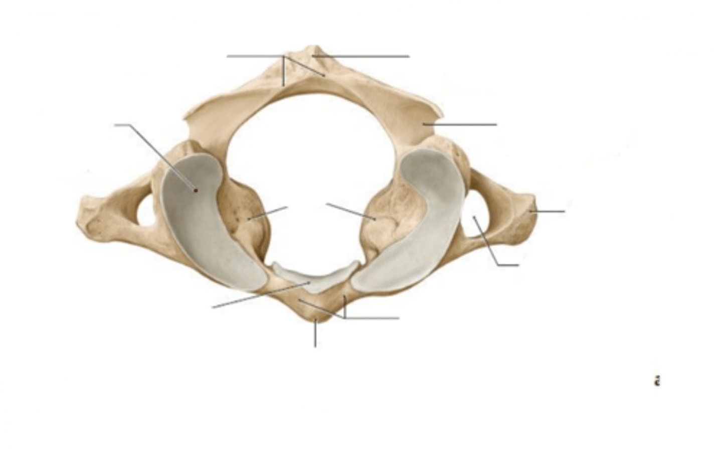 <p>What type of vertebra is shown?</p>