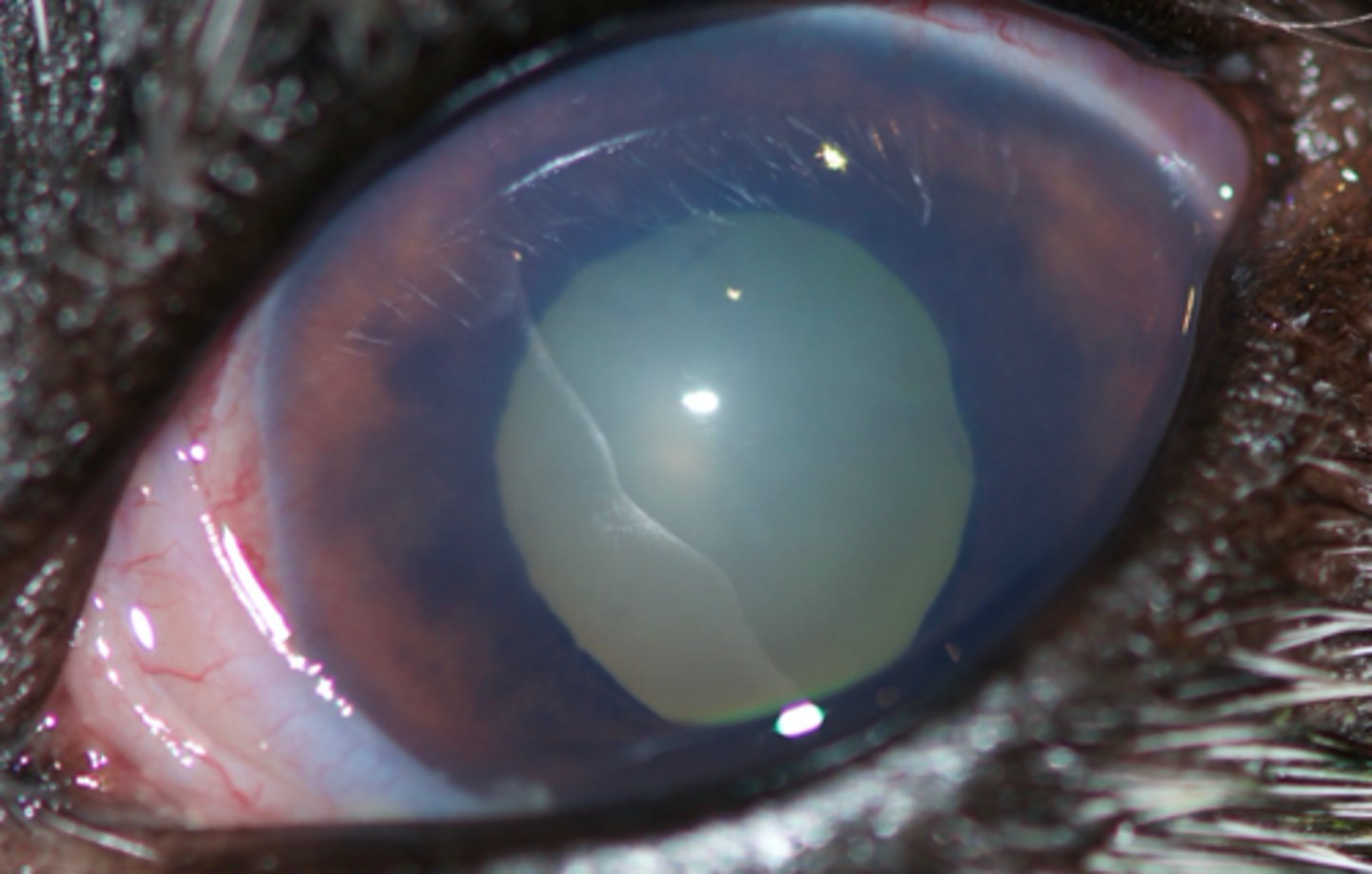 <p>Loss of transparency in the cornea leading to vision impairment</p>