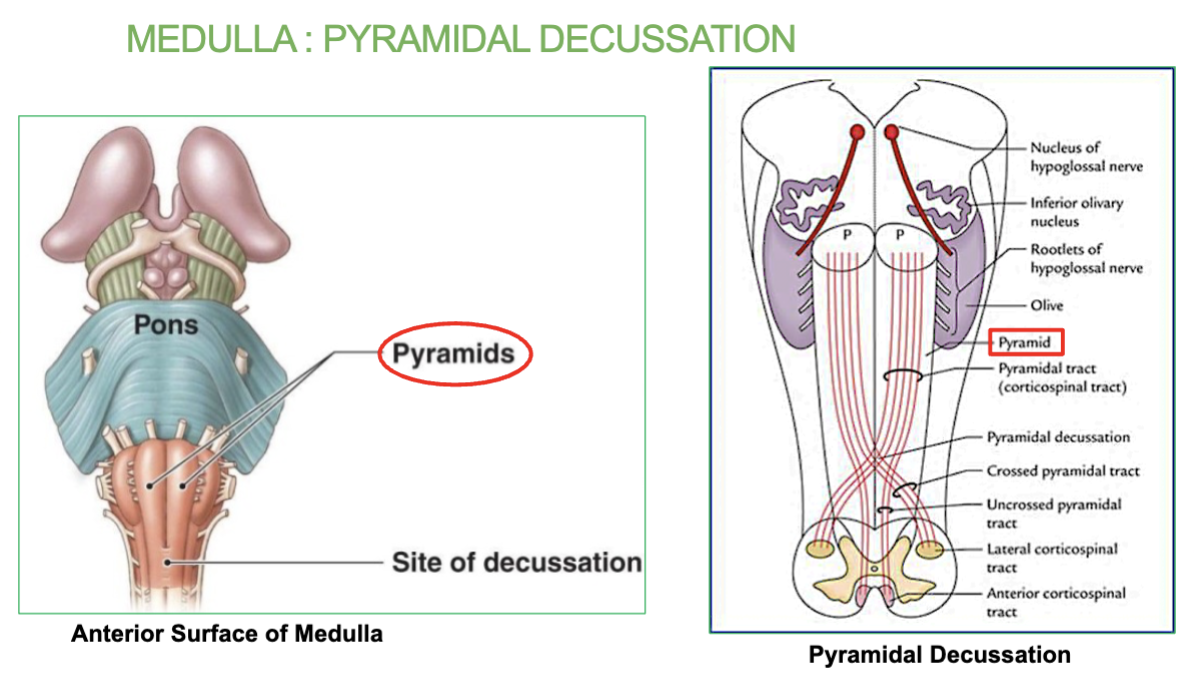<p>Area where most of the motor f<strong>ibers cross to the other side</strong>. occurs in the medulla.</p><p>→ <em>Explains how lesions on one side of the brain may result in motor deficit on the</em></p><p><em>contralateral (opposite) side of the body</em></p>