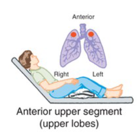 <p>What CPT position is pictured, and when is it used?</p>