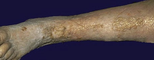 term image