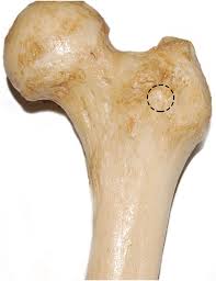 <p>a subtle struchture </p>