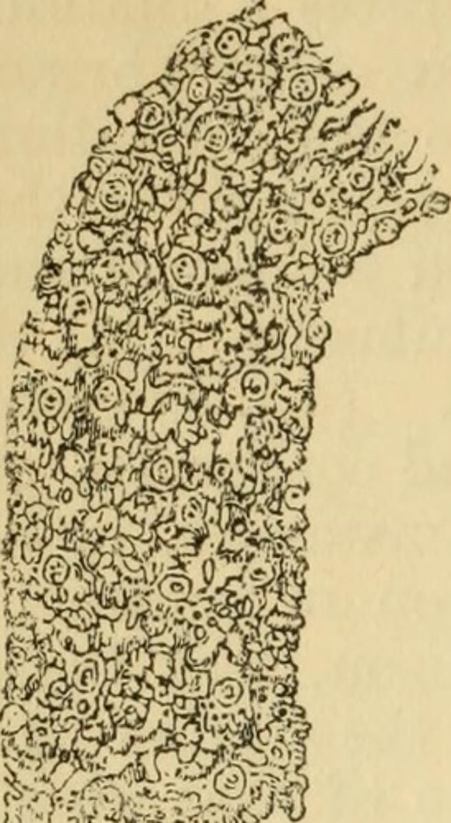 <p>The number of people per unit of area of arable land, which is land suitable for agriculture.</p>
