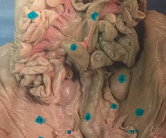 <p>What is structure #8? What’s it function? </p>