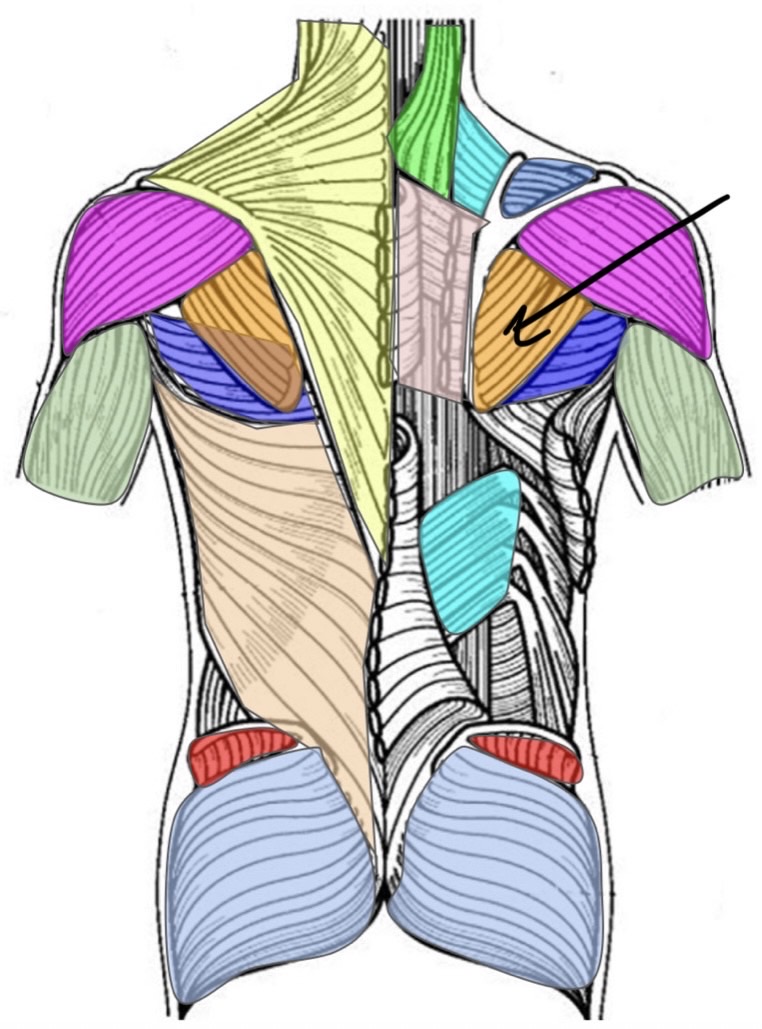 term image